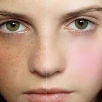 Những sai lầm khi chọn cơ sở để đi làm đẹp