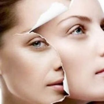 Trẻ đẹp da với tế bào gốc tự thân